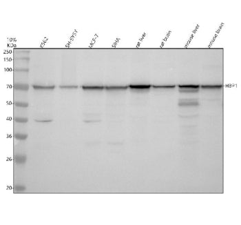 Western blot analysis of HBP1 using anti-HBP1 antibody. Electrophoresis was performed on a 10% SDS-P