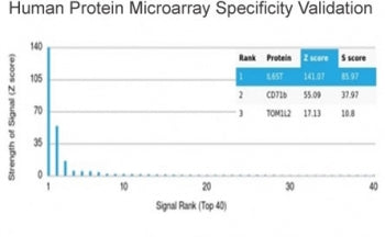 Analysis of HuProt(TM) microarray containing more than 19,000 full-length human proteins using Inter