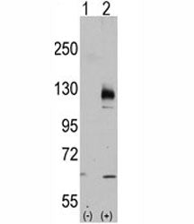 TRPM8 Antibody