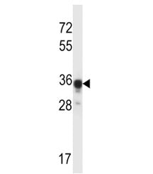 ABHD4 antibody western blot analysis in mouse kidney tissue lysate. Predicted molecular weight ~39 kDa.