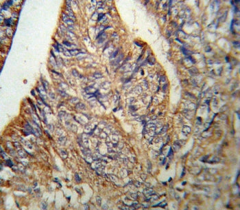 IL1RN Antibody / IL1RA / Interleukin-1 Receptor Antagonist