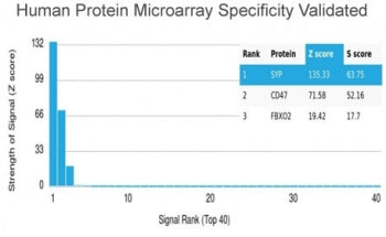 Analysis of HuProt(TM) microarray containing more than 19,000 full-length human proteins using recom