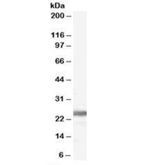 Western blot testing of human testis lysate with Ribosomal Protein L19 antibody at 0.1ug/ml. Expecte