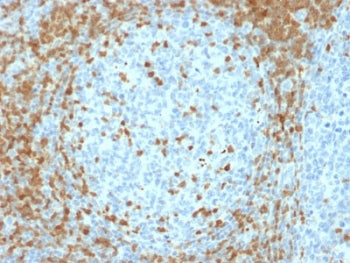 IHC testing of FFPE human tonsil tissue with ZAP70 antibody (clone ZAP70/2035). HIER: boil tissue se