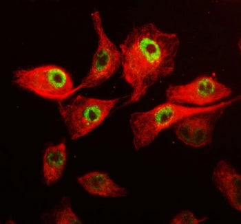 Immunofluorescent staining of FFPE human A549 cells with CDK12 antibody (green) and Beta Tubulin mAb