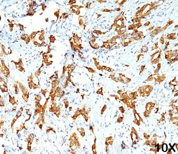HSP27 Antibody / HSPB1