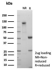 NSE Antibody / Neuron Specific Enolase