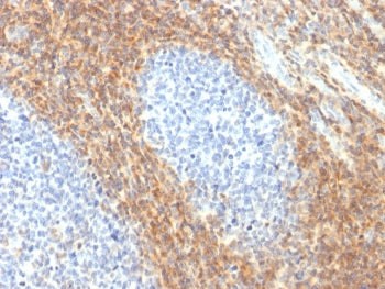 IHC testing of human tonsil tissue with recombinant CD52 antibody (clone CD52/2276R). Required HIER: