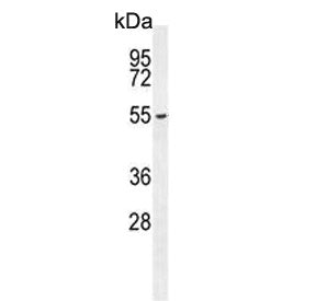 Western blot testing of mouse bladder tissue lysate with FBXW8 antibody. Predicted molecular weight 
