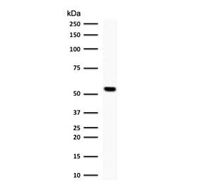 Western blot testing of human Jurkat cell lysate with TOP1MT antibody (clone TPIMT-1). Predicted mol