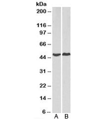 Western blot testing of human A) HeLa and B) MCF7 cell lysate with PRKACA antibody at 2ug/ml. Predic