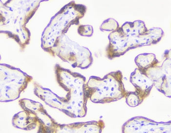 IHC testing of FFPE human placental tissue with recombinant MMP3 antibody (clone MXMP3-1R). Required