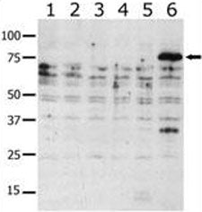 PAK6 Antibody