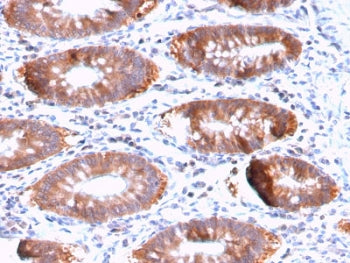 IHC testing of FFPE human colon tissue with recombinant Aurora B antibody (clone AURKB/3121R). HIER: