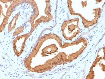 PSA Antibody / Prostate Specific Antigen