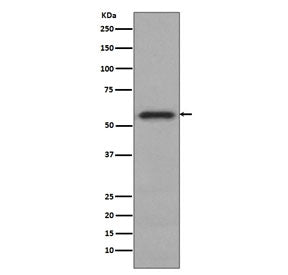 Western blot testing of human HeLa cell lysate with c-Myc antibody. Theoretical molecular weight: ~5