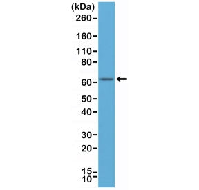 Western blot of human MCF-7 cell lysates using recombinant Estrogen Receptor alpha antibody at a 1:5