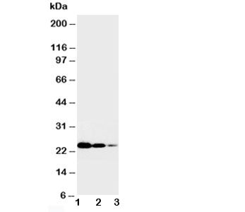 TNFR1 Antibody