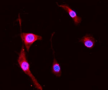 Immunofluorescent staining of FFPE mouse NIH 3T3 cells with S100A8 antibody (red) and DAPI nuclear s