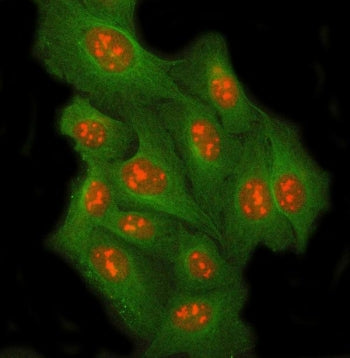 RRP8 Antibody / Ribosomal RNA-processing protein 8