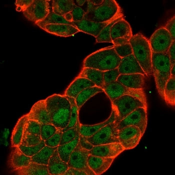 Immunofluorescent staining of PFA-fixed human MCF-7 cells using p65 NF-kB antibody (green, clone PCR