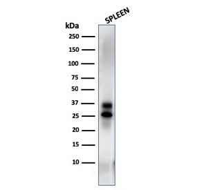 Western blot testing of human spleen lysate with Granzyme B antibody (clone GZMB/3014). Predicted mo