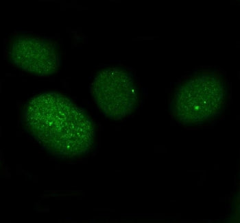 Immunofluorescent staining of FFPE human U-2 OS cells with XAF1 antibody. HIER: steam section in pH6
