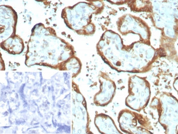 IHC staining of FFPE human placental tissue with IMP3 antibody (clone IMP3/8934R) Inset: PBS used in