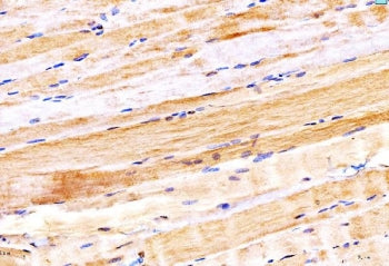 IHC staining of FFPE human heart tissue with Myosin 6 antibody. HIER: boil tissue sections in pH8 ED