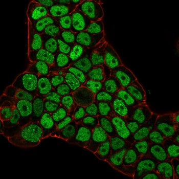 Immunofluorescence staining of PFA-fixed human MCF-7 cells with MSH6 antibody (green, clone MSH6/308