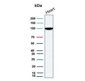 Western blot testing of human heart tissue lysate with N-Cadherin antibody (clone CDH2/8998R). Predi