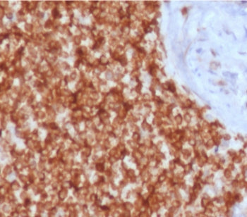 IHC testing of FFPE human spleen tissue with recombinant Bcl-2 antibody (clone ARBC2-2R). HIER: boil