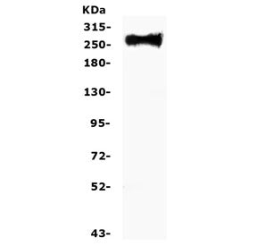 Western blot testing of human U-87 MG cell lysate with Fibronectin antibody. Predicted molecular wei