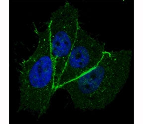 Fluorescent confocal image of MCF7 cells stained with phospho-ERBB2 antibody at 1:100. Note the high
