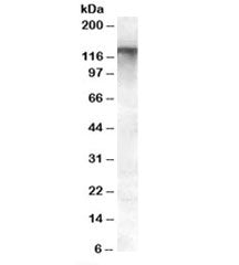 Western blot testing of human breast lysate with MRP8 antibody at 0.5ug/ml. Predicted molecular weig