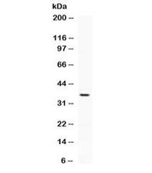 PD-L2 Antibody / Programmed death ligand 2 / CD273
