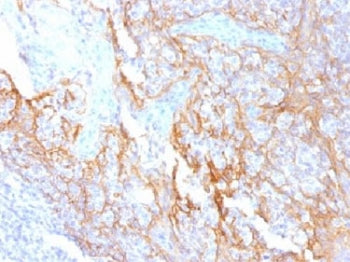 IHC testing of FFPE human tonsil tissue with Beta Catenin antibody (clone 15B8). Required HIER: boil