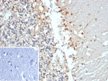IHC staining of FFPE human brain tissue with recombinant Creatine kinase B antibody (clone CKBB/8306