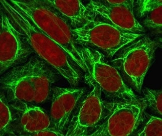 Cytokeratin 18 Antibody