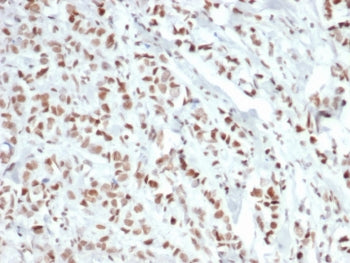 Estrogen Receptor alpha Antibody