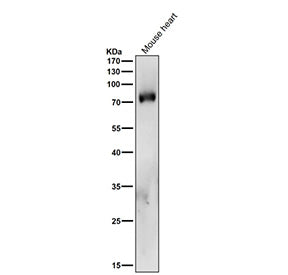 Mouse heart tissue lysate tested with PKC delta/theta Antibody at 1:1000 dilution for 1 hour at room