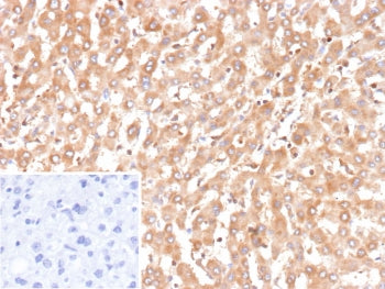 IHC staining of FFPE human liver tissue with recombinant BCL2L4 antibody (clone BAX/9925R). Inset: P