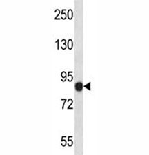 NLRP6 antibody western blot analysis in human placenta tissue lysate. Predicted molecular weight ~99