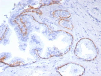 IHC staining of FFPE human prostate tissue with recombinant KRT5 antibody (clone rKRT5/6969). HIER: 