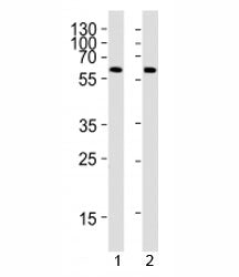 Western blot analysis of 1) human placenta and 2) mouse heart tissue lysate using PPARG antibody at 