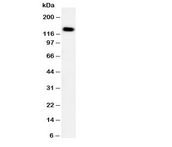 Western blot testing of PTCH2 antibody and human HeLa cell lysate. Expected molecular weight ~130 kD