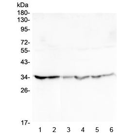 Western blot testing of human 1) HeLa, 2) placenta, 3) U-2 OS, 4) Caco-2, 5) SW620 and 6) A549 lysat