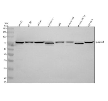 Western blot analysis of SLC27A2 using anti-SLC27A2 antibody. Electrophoresis was performed on a 10%