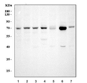 Western blot testing of 1) human HeLa, 2) human A549, 3) human Jurkat, 4) human HepG2, 5) rat testis