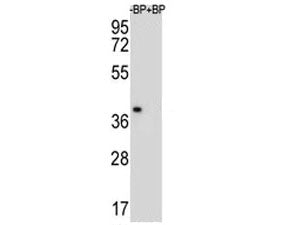 Western blot analysis of MBP antibody and NCI-H460 lysate. Multiple isoforms visualized from 20~37 k